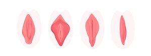 Four images of women’s reproductive system with varying shapes and sizes.